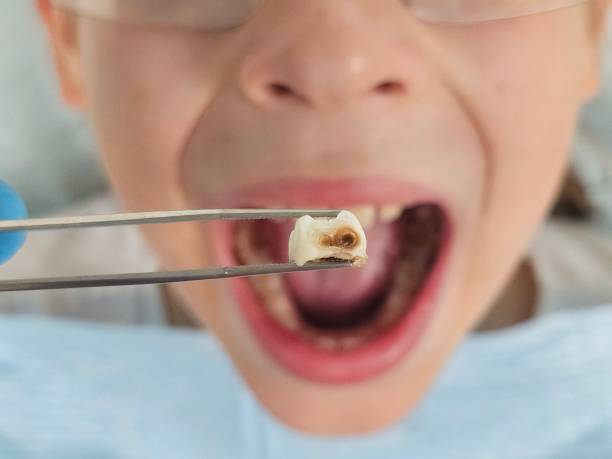Best Pediatric Emergency Dentist in Tilden, NE